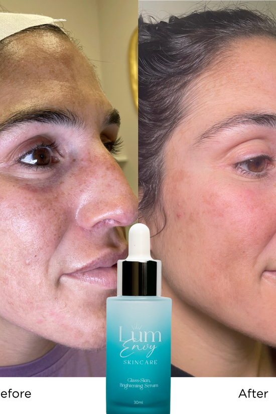 Glass Skin Brightening Serum