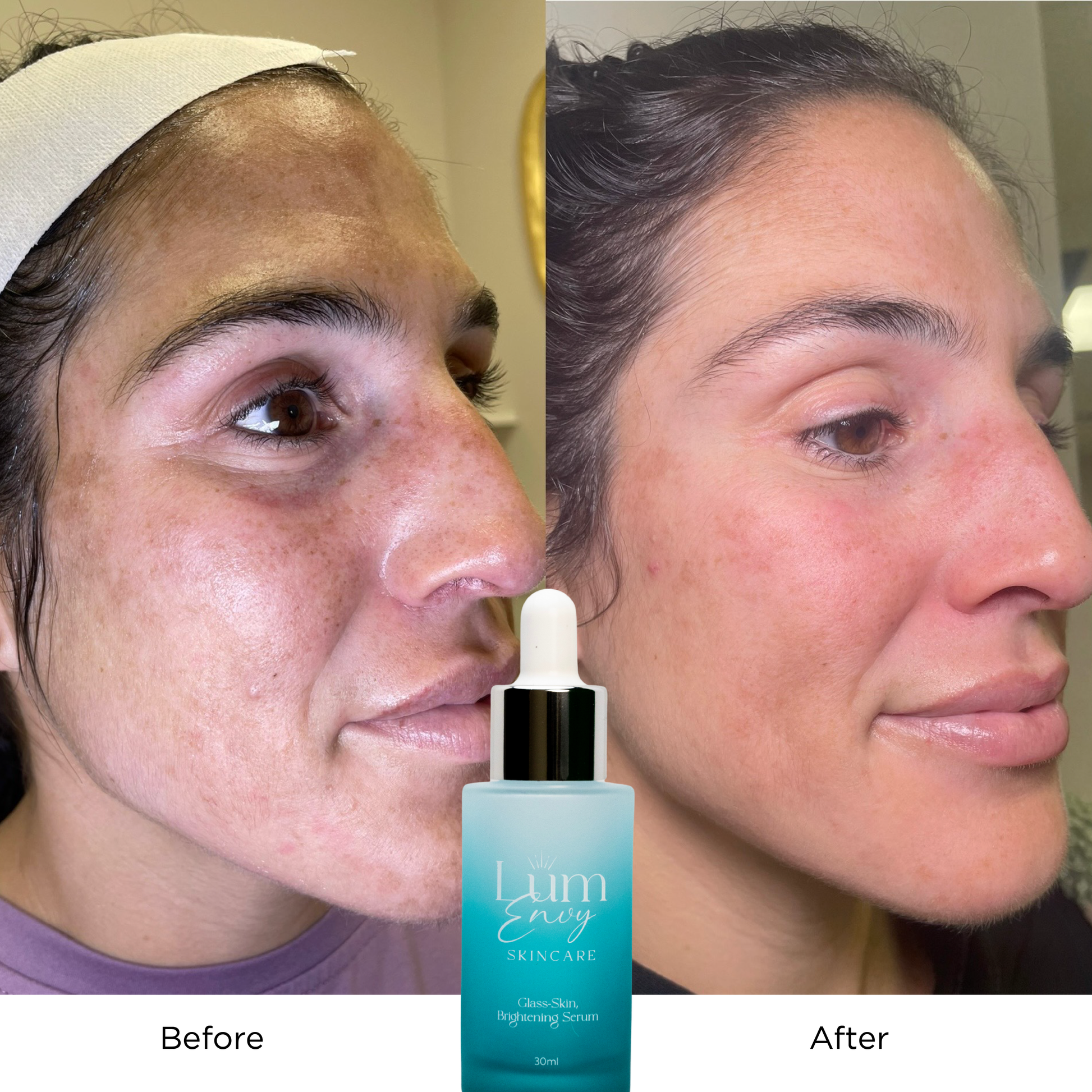 Glass Skin Brightening Serum